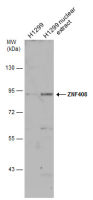 ZNF408 antibody