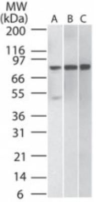 IKK beta antibody [10AG2]