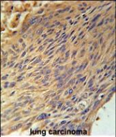 CPEB4 antibody