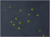 VCP antibody [Hs-14]