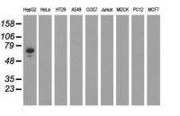 Alpha fetoprotein / AFP antibody [1E8]