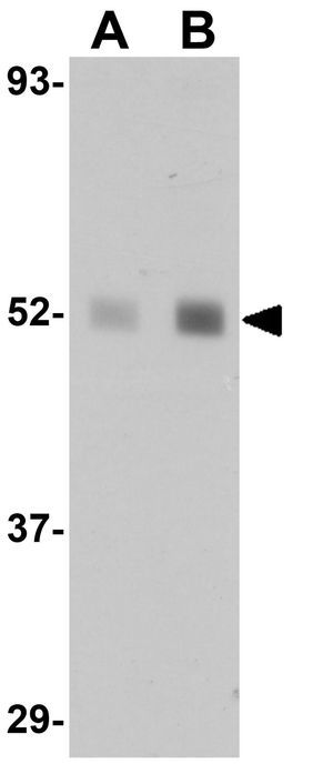 LXR beta antibody