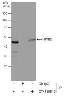 SMYD2 antibody