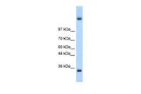 DAZ4 antibody, N-term