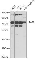 Arginyl tRNA synthetase antibody
