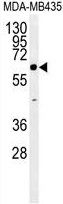 ERO1LB antibody