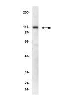 alpha Actinin 1 antibody [0.T.02]