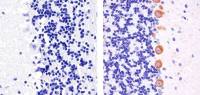 PKC gamma (phospho Thr674) antibody