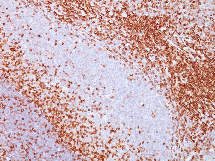 CD43 antibody [SPN/839]