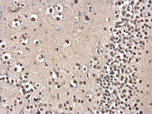 PSPC1 antibody