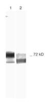 MMP2 antibody [2C1]