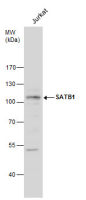 SATB1 antibody