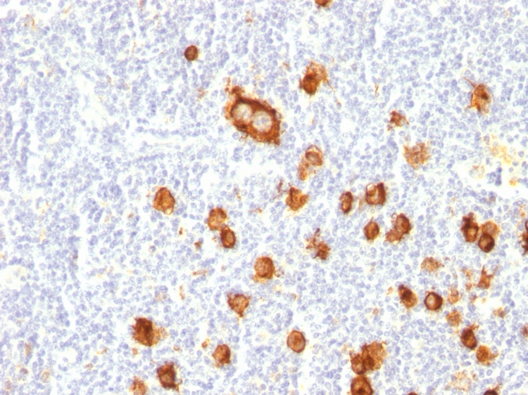 SSEA-1 / CD15 antibody [FUT4/815]