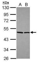 EIF4A2 antibody
