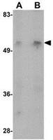 MATN1 antibody