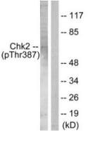 Chk2 (phospho Thr387) antibody