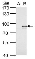 Alkyl-DHAP synthase antibody