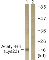 Histone H3K23ac (Acetyl Lys23) antibody