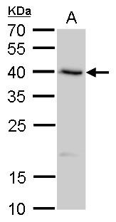 SerpinB8 antibody