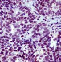 Thyroid Hormone Receptor beta antibody [SPM222]