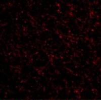 Neurokinin 3 Receptor antibody