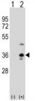 COLEC11 antibody, N-term