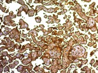 Placental Alkaline Phosphatase antibody [SPM593]
