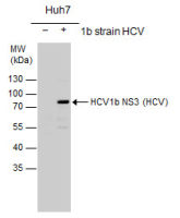Hepatitis C virus NS3 protein antibody