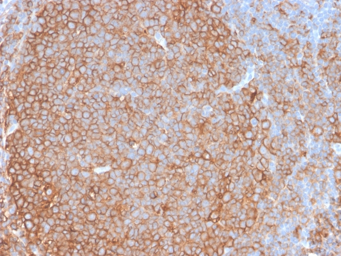MHC Class II antibody [HLA-Pan/2967R]