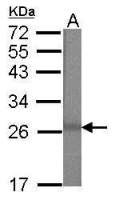 MBD3 antibody [N1C3]