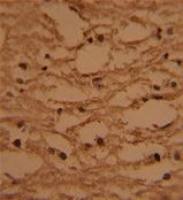 HTATSF1 antibody, N-term