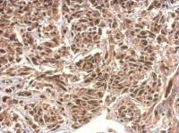 KIAA0323 antibody [C2C3], C-term