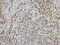 RbAp48 antibody [N1C2]