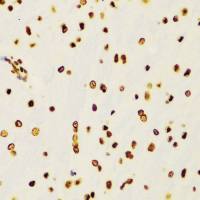 Histone H3K4me2 (di-methyl Lys4) antibody