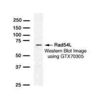 RAD54L antibody [38.4]