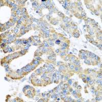 ATPIF1 antibody