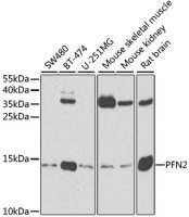 Profilin 2 antibody