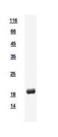 Human DUSP21 protein, His tag