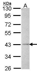 ALS2CR2 antibody [C3], C-term