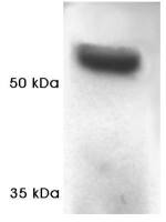 Proteasome 19S Subunit S4 antibody