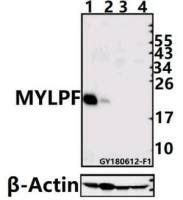 fast skeletal Myosin antibody
