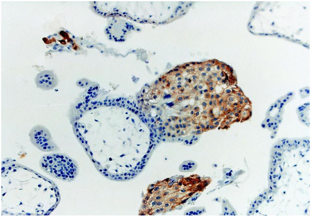 HLA-G antibody [MEM-G/1]