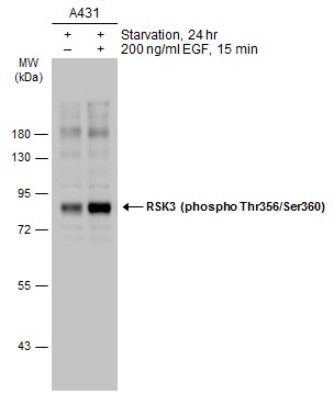 RSK3 (phospho Thr356/Ser360) antibody
