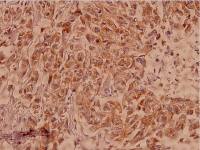 Claudin 7 antibody