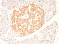 TNF alpha antibody [TNF706]