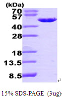 Human EBP1 protein, His tag