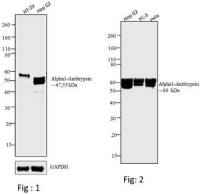 alpha 1 Antitrypsin antibody [TMF1#4B5]