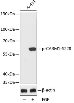 CARM1 (phospho Ser228) antibody