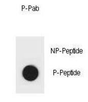 IKK beta (phospho Ser701) antibody