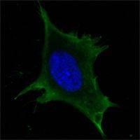 Calreticulin antibody [1G6A7]
